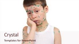  Presentation with virus - PPT theme consisting of child has the virus background and a  colored foreground