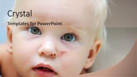  Presentation with physical child abuse - Beautiful presentation design featuring child physical abuse - portrait of litlle girl backdrop and a lemonade colored foreground