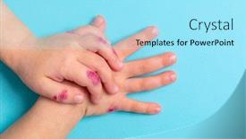  Presentation with dermatitis - Theme with children-hand-with-dermatitis-eczema background and a arctic colored foreground