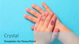  Presentation with dermatitis - Slide deck featuring children-hand-with-dermatitis-eczema background and a arctic colored foreground