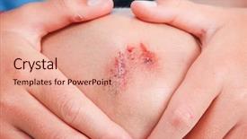  Presentation with knee - Amazing presentation design having children injury - child holding their knee backdrop and a coral colored foreground