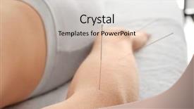  Presentation with acupuncture - Colorful theme enhanced with chinese - therapy of female arm backdrop and a light gray colored foreground