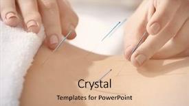  Presentation with acupuncture - Presentation having chinese - young woman undergoing acupuncture treatment background and a coral colored foreground