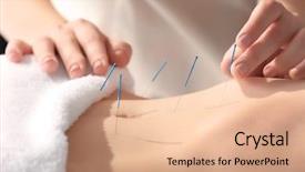  Presentation with acupuncture - Beautiful slide deck featuring chinese - young woman undergoing acupuncture treatment backdrop and a coral colored foreground