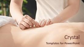  Presentation with acupuncture - PPT theme enhanced with chinese medicine - young woman undergoing acupuncture treatment background and a lemonade colored foreground