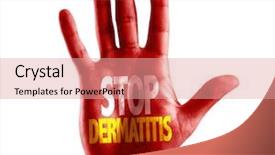  Presentation with dermatitis - Amazing PPT layouts having chronic health conditions - stop dermatitis written on hand backdrop and a coral colored foreground