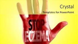  Presentation with stop - Amazing slide set having chronic health conditions - stop eczema written on hand backdrop and a white colored foreground