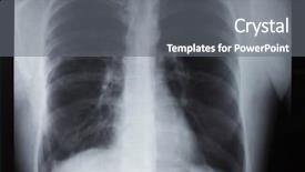  Presentation with car accident - Amazing presentation design having clavicle x-ray car accident backdrop and a gray colored foreground