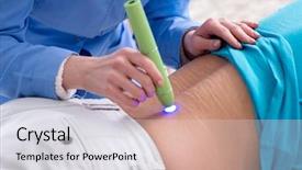  Presentation with laser - Beautiful slides featuring clinic undergoing laser scar backdrop and a light gray colored foreground