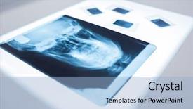 Presentation with skull - Theme consisting of close up of a x-ray of a human skull on the table at the dental clinic background and a light blue colored foreground