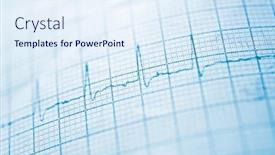  Presentation with paper - Slide deck with close-up-of-an-electrocardiogram background and a sky blue colored foreground