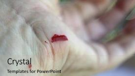  Presentation with cut - Cool new slides with close up of bleeding cut backdrop and a mint green colored foreground