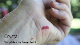  Presentation with vaginal bleeding - Theme enhanced with close up of bleeding cut background and a light gray colored foreground