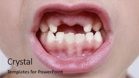  Presentation with parent child teen - Slide set featuring child's month with missing background and a coral colored foreground