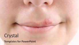  Presentation with herpes virus - Cool new presentation theme with closeup of a common cold backdrop and a lemonade colored foreground