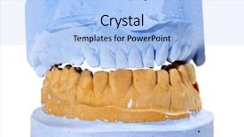  Presentation with dental - Colorful PPT layouts enhanced with closeup of a dental mould backdrop and a light blue colored foreground
