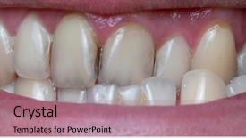  Presentation with plaque - Theme having closeup of dental plaque background and a coral colored foreground