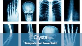  Presentation with science - Presentation theme consisting of collage of many x-rays background and a teal colored foreground