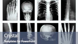  Presentation with science - Colorful slide set enhanced with collage of many x-rays backdrop and a ocean colored foreground