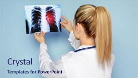  Presentation with lung cancer - Theme consisting of color background lung cancer background and a sky blue colored foreground
