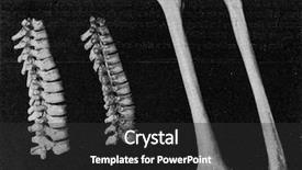  Presentation with breast - Cool new PPT layouts with columns - comparative table of the vertebral backdrop and a dark gray colored foreground