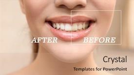  Presentation with teeth whitening - Cool new slides with comparative results - result of teeth whitening smiling backdrop and a coral colored foreground