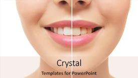  Presentation with teeth whitening - Slide deck featuring comparative results - result of teeth whitening smiling background and a coral colored foreground