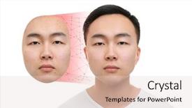  Presentation with acne - Cool new presentation with comparative results - young man backdrop and a  colored foreground