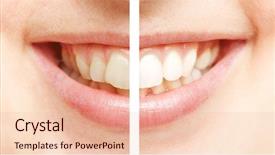  Presentation with teeth whitening - Beautiful PPT theme featuring tooth background - comparison between white teeth backdrop and a lemonade colored foreground