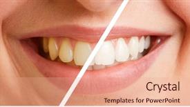  Presentation with comparison - Colorful slides enhanced with comparison of teeth of a young woman before and after a tooth cleaning backdrop and a coral colored foreground