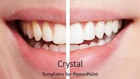  Presentation with comparison - Colorful slide set enhanced with comparison of teeth backdrop and a coral colored foreground