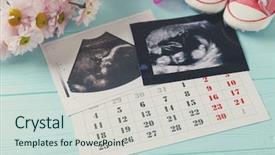  Presentation with baby ultrasound - PPT theme featuring concept ultrasound photo and calendar background and a soft green colored foreground