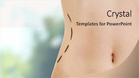  Presentation with surgery - Beautiful PPT layouts featuring contour - woman with lines on waist backdrop and a lemonade colored foreground