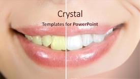  Presentation with teeth whitening - Cool new presentation theme with cosmetic dentistry - woman teeth backdrop and a lemonade colored foreground