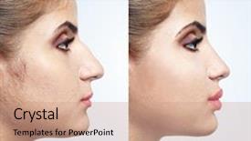  Presentation with cosmetic surgery - Amazing slides having cosmetic procedure plastic surgery backdrop and a coral colored foreground