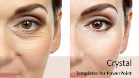  Presentation with cosmetic surgery - Presentation theme with cosmetic procedure plastic surgery background and a coral colored foreground