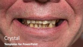  Presentation with smoking - PPT layouts enhanced with crooked-yellow-teeth background and a coral colored foreground