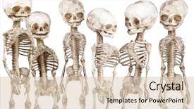  Presentation with death children - PPT theme enhanced with child death - many children's human medical skeleton background and a lemonade colored foreground