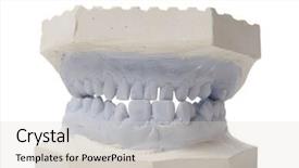  Presentation with plaster - Beautiful slide set featuring dental examining plaster dents model backdrop and a lemonade colored foreground