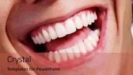  Presentation with funny - Slide set consisting of dental funny - close up shot of awesome background and a red colored foreground