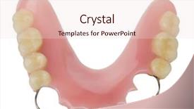  Presentation with dental prosthesis - Slide set consisting of dental prosthesis background and a  colored foreground