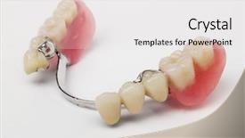  Presentation with dental prosthesis - Audience pleasing slides consisting of dental prosthesis backdrop and a white colored foreground