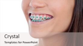  Presentation with dental - Presentation theme having dental retainers - attractive young woman with brackets background and a lemonade colored foreground