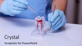  Presentation with tooth root - Beautiful presentation theme featuring dental root - dentist working with artificial tooth backdrop and a sky blue colored foreground