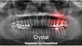  Presentation with panoramic - Colorful PPT theme enhanced with dental root - panoramic x-rays of teeth backdrop and a dark gray colored foreground
