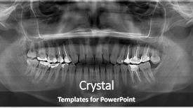  Presentation with panoramic - Cool new slide deck with dental root - panoramic x-rays of teeth backdrop and a dark gray colored foreground