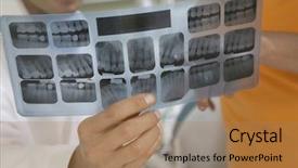  Presentation with dentist xray - Beautiful presentation featuring dental xray - dentist holding tooth x-ray report backdrop and a coral colored foreground