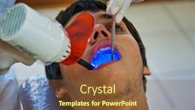  Presentation with dentist - Amazing theme having dentist-ultraviolet-light-checking-up backdrop and a tawny brown colored foreground