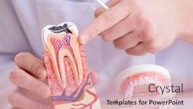  Presentation with dentist - Cool new presentation theme with dentist-working-teeth-implant backdrop and a lemonade colored foreground