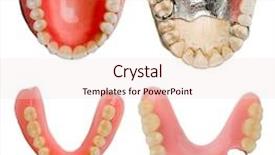  Presentation with dental materials - Colorful presentation design enhanced with dentistry braces - dental prosthetics collection backdrop and a  colored foreground